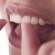 Reasons For Your Dental Problems and What You should Do